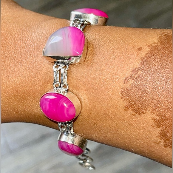 Pink Botswana Banded Agate Bracelet 6 1/2” - 7 1/2” - Picture 2 of 8